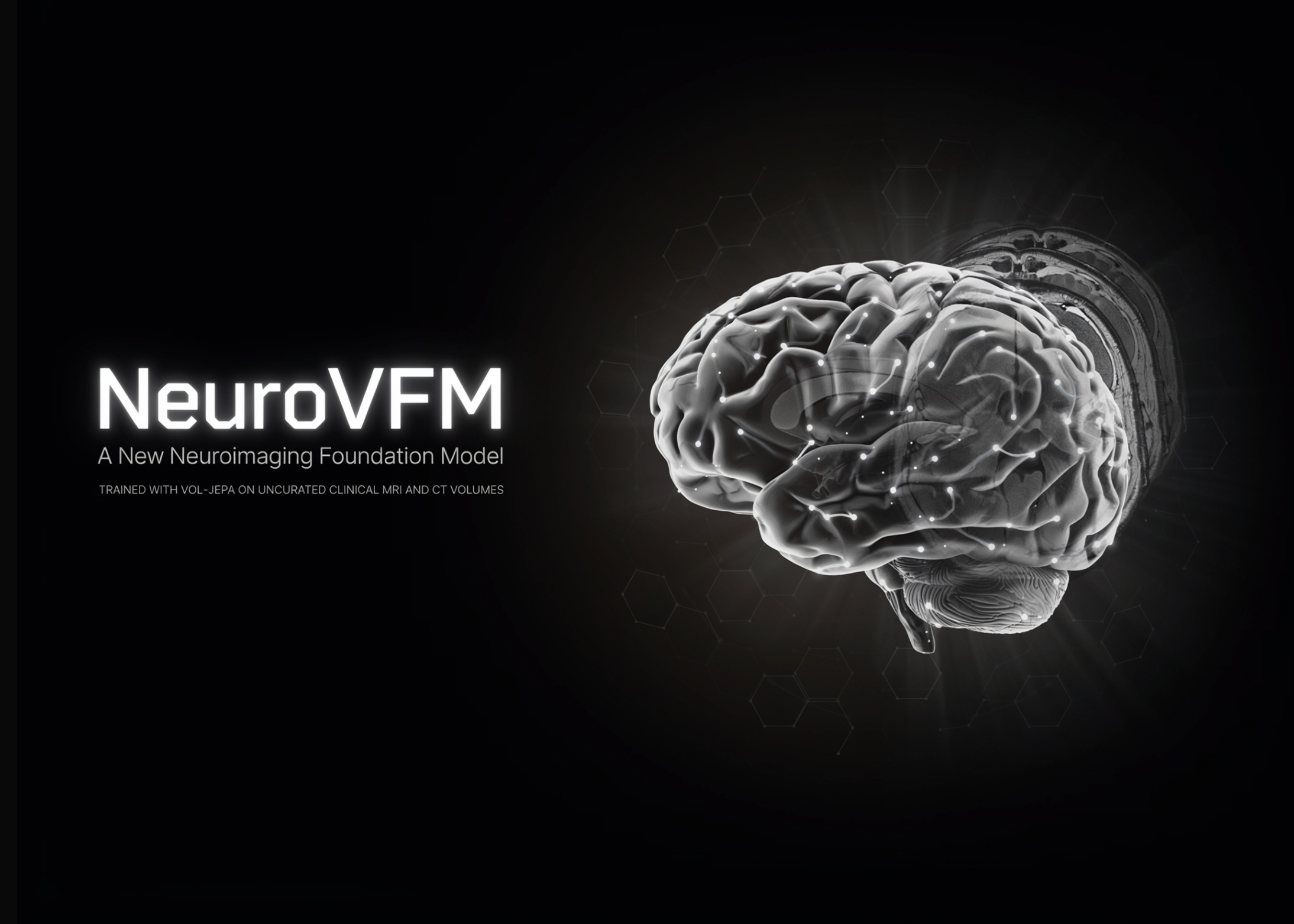 Découvrez NeuroVFM : un nouveau modèle de base en neuroimagerie entraîné avec Vol-JEPA sur des volumes d'IRM et de tomodensitométrie cliniques non triés